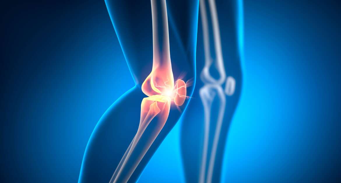 Knee Pain